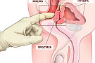 Предстательная железа (простата)